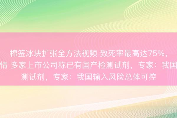 棉签冰块扩张全方法视频 致死率最高达75%，印度现尼帕病毒疫情 多家上市公司称已有国产检测试剂，专家：我国输入风险总体可控